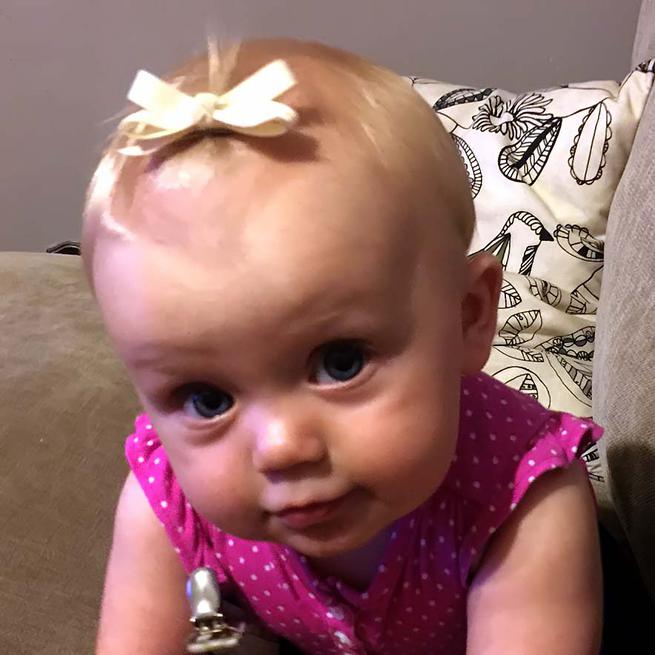 hair accessories for bald baby girl